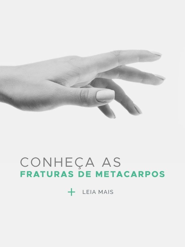 Fratura de Metacarpos | Dr. Fernando Moya